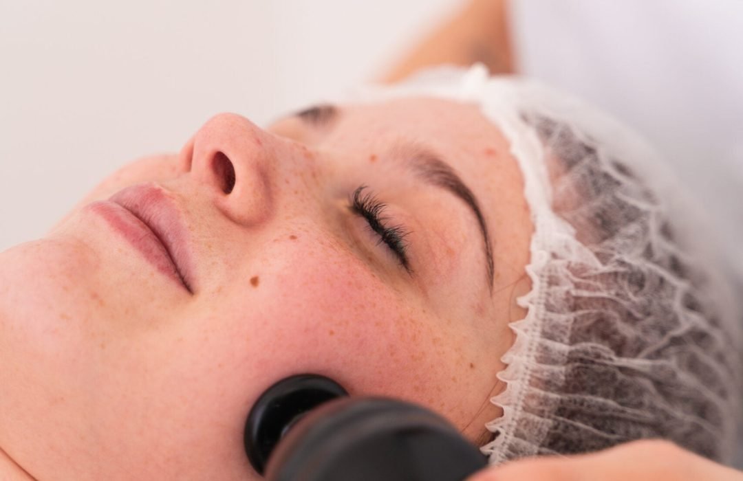 La fisioterapeuta Laura Bracero realizando fisioestética facial y aplicando la mesoterapia virtual y la diatermia sobre la piel de la cara de una paciente.