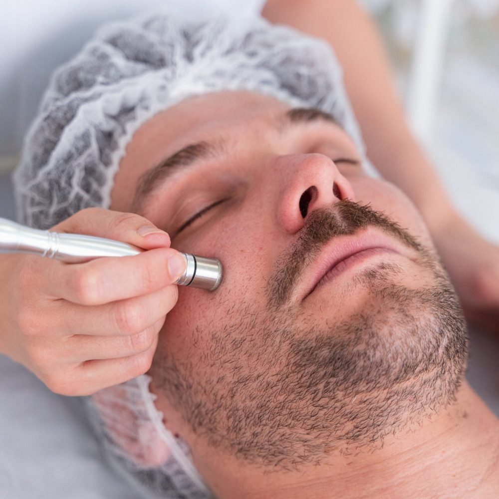 La fisioterapeuta Laura Bracero realizando fisioestética facial a un paciente con microdermoabrasión.